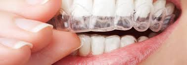 How much does teeth whitening cost?